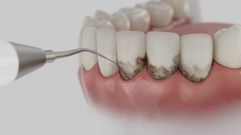 Reliable Dental Implants contractor in Long Beach, MS by Smile Center Dentistry